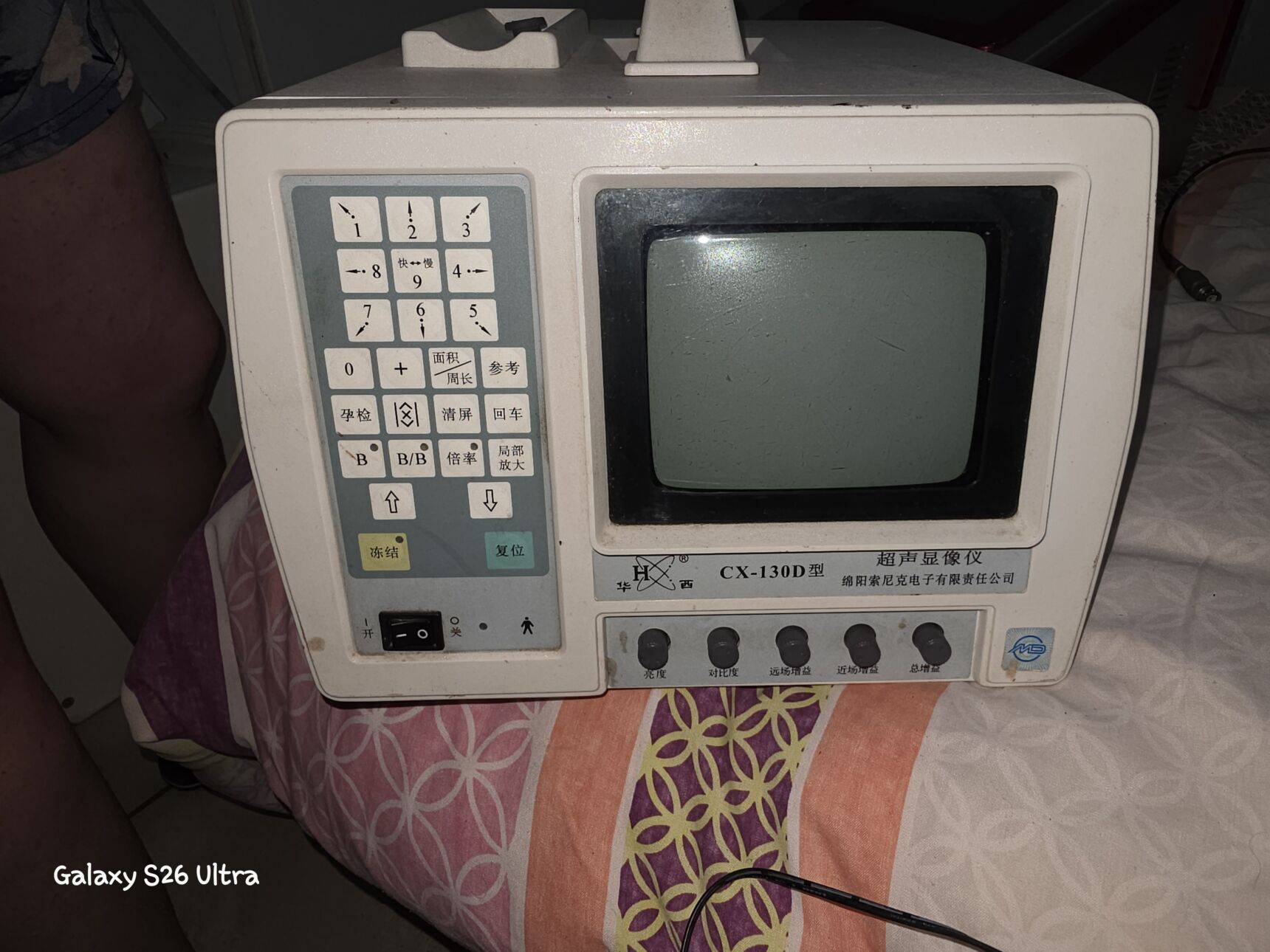 Ultrasound Monitor